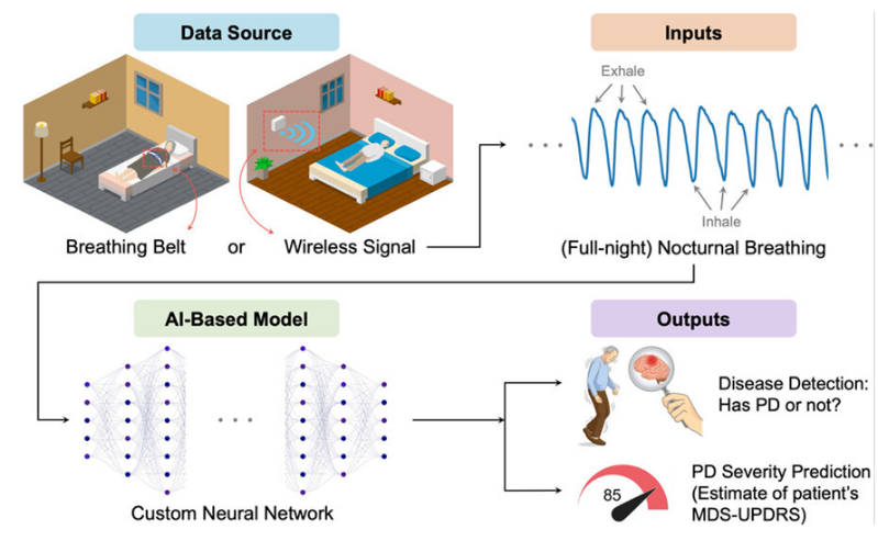 Using artificial intelligence to detect Parkinson's disease by reading people's breathing patterns